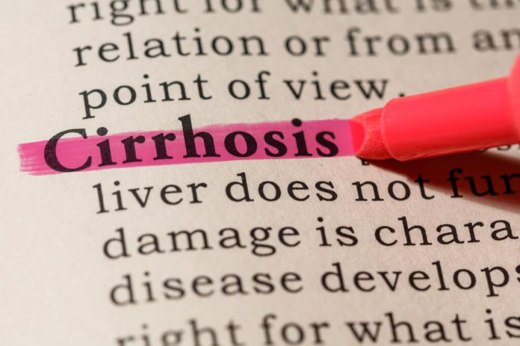 Definition of cirrhosis