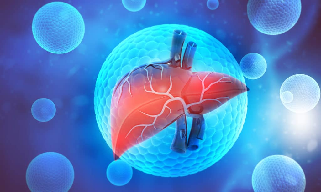 Fatty liver disease - maitland 1