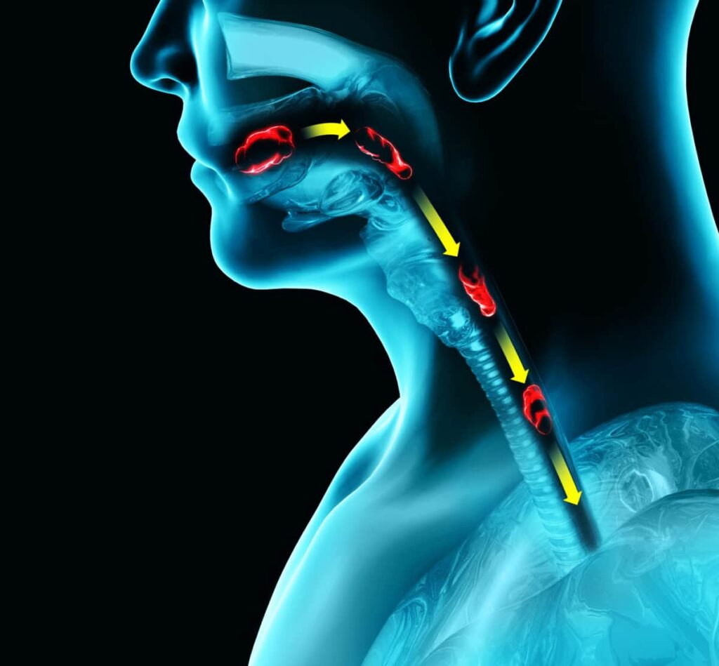 Disorders of swallowing, dysphagia. Pharyngeal and esophageal dy