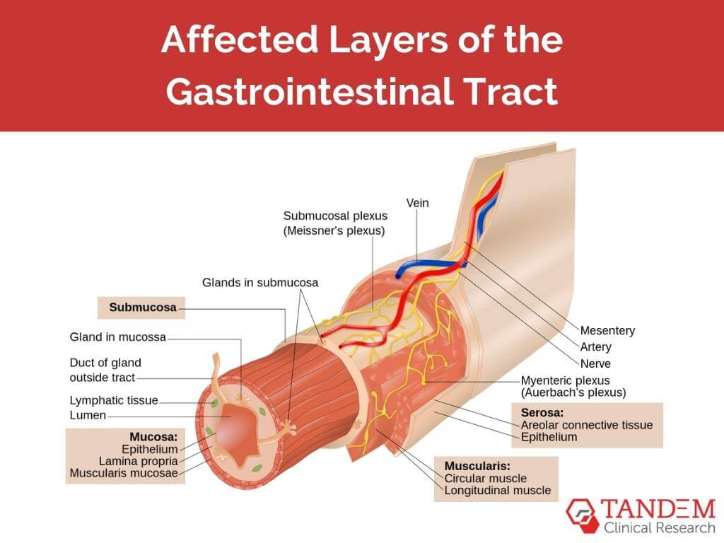 Affected layers of gastrointestinal tract