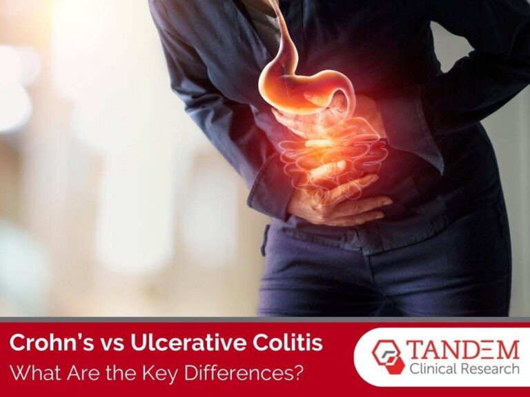 Crohn's disease vs ulcerative colitis feature image