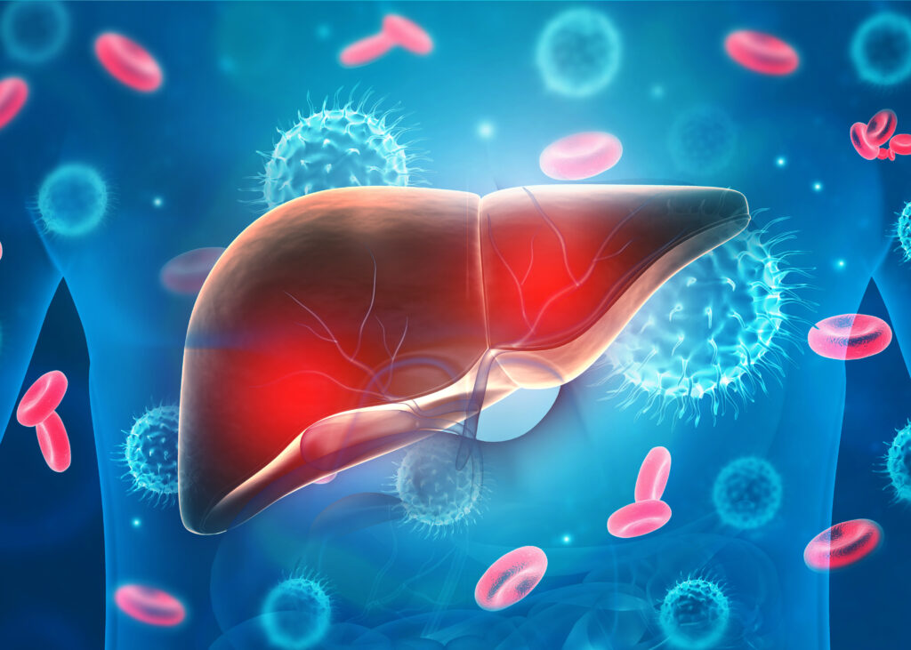 Take the Fatty Liver Disease Quiz Tandem Clinical Research